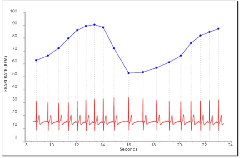 Heart Rate Variability Overview HeartMath Help